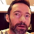 Kiújult Hugh Jackman rákja! Kiújult Hugh Jackman rákja!