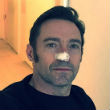 Kiújult Hugh Jackman rákja Kiújult Hugh Jackman rákja